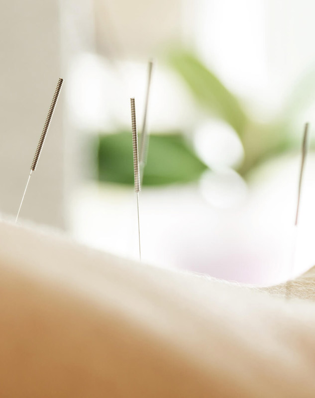 Acupuncture-Brampton