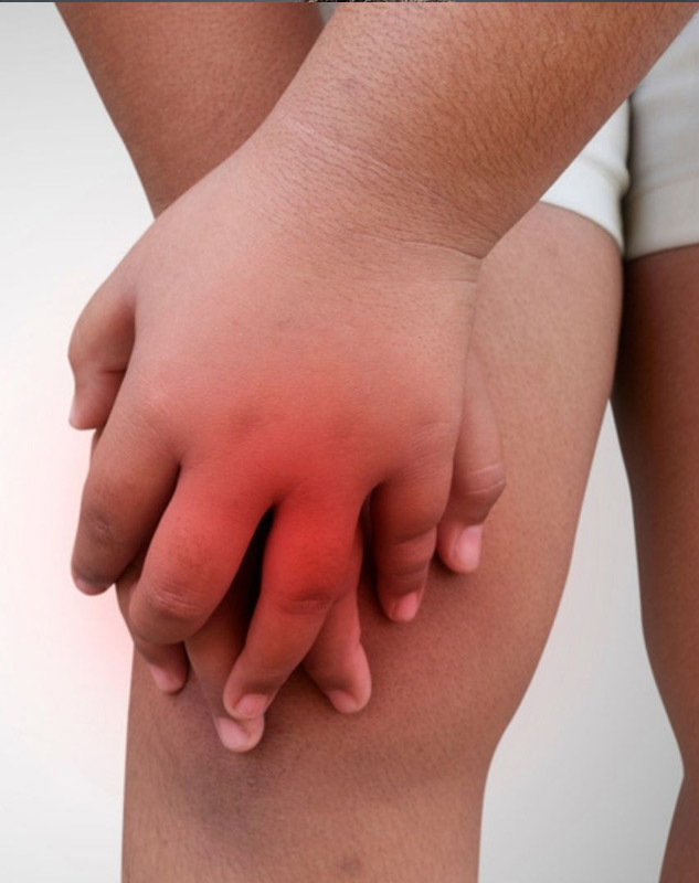 arthirtis-treatments